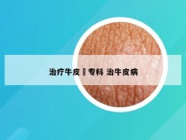 治疗牛皮廯专科 治牛皮病