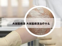 大虢医癣清 大虢医癣清治疗什么