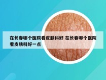 在长春哪个医院看皮肤科好 在长春哪个医院看皮肤科好一点