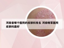 河南省哪个医院的皮肤科有名 河南哪家医院皮肤科最好