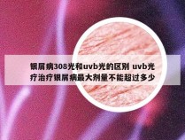 银屑病308光和uvb光的区别 uvb光疗治疗银屑病最大剂量不能超过多少