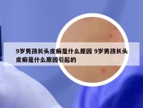 9岁男孩长头皮癣是什么原因 9岁男孩长头皮癣是什么原因引起的