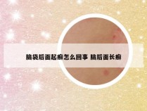 脑袋后面起癣怎么回事 脑后面长癣