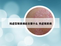 阳虚型银屑病应主要什么 阴虚银屑病