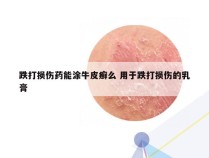 跌打损伤药能涂牛皮癣么 用于跌打损伤的乳膏