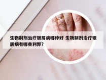 生物制剂治疗银屑病哪种好 生物制剂治疗银屑病有哪些利弊?