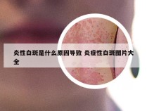 炎性白斑是什么原因导致 炎症性白斑图片大全