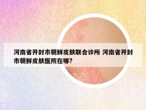 河南省开封市朝鲜皮肤联合诊所 河南省开封市朝鲜皮肤医院在哪?