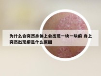 为什么会突然身体上会出现一块一块癣 身上突然出现癣是什么原因