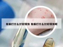 有癣打什么针好得快 有癣打什么针好得快呢