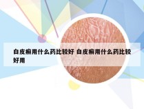 白皮癣用什么药比较好 白皮癣用什么药比较好用