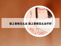 腿上害癣怎么冶 腿上害癣怎么冶疗好