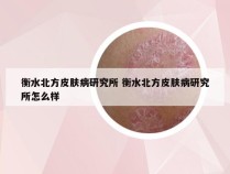 衡水北方皮肤病研究所 衡水北方皮肤病研究所怎么样