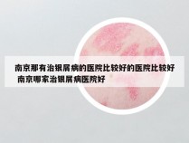 南京那有治银屑病的医院比较好的医院比较好 南京哪家治银屑病医院好