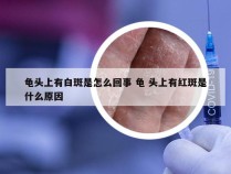 龟头上有白斑是怎么回事 龟 头上有红斑是什么原因