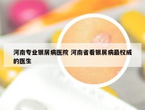 河南专业银屑病医院 河南省看银屑病最权威的医生