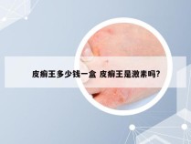 皮癣王多少钱一盒 皮癣王是激素吗?