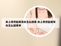 身上突然起癣发白怎么回事 身上突然起癣发白怎么回事啊