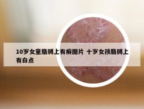 10岁女童胳膊上有癣图片 十岁女孩胳膊上有白点