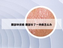 腰部块状癣 腰部长了一块癣怎么办