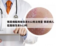 银屑病服用维生素B12用法用量 银屑病人能服维生素b12吗