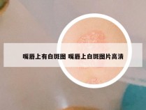 嘴唇上有白斑图 嘴唇上白斑图片高清