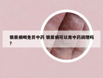 银屑病喝免剪中药 银屑病可以用中药调理吗?