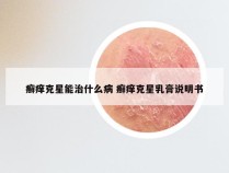 癣痒克星能治什么病 癣痒克星乳膏说明书