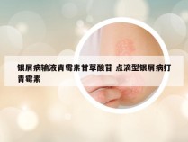 银屑病输液青霉素甘草酸苷 点滴型银屑病打青霉素