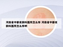 河南省中都皮肤科医院怎么样 河南省中都皮肤科医院怎么样啊