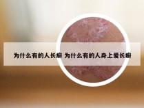 为什么有的人长癣 为什么有的人身上爱长癣