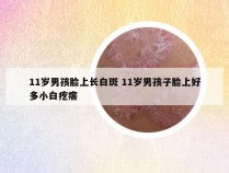 11岁男孩脸上长白斑 11岁男孩子脸上好多小白疙瘩