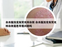 白衣服洗完有荧光样白斑 白衣服洗完有荧光样白斑是色牢度问题吗