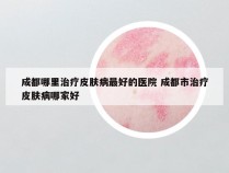 成都哪里治疗皮肤病最好的医院 成都市治疗皮肤病哪家好