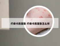 疗癣卡西莆散 疗癣卡西莆散怎么样