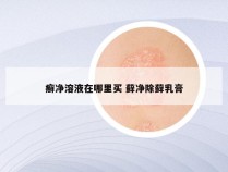 癣净溶液在哪里买 藓净除藓乳膏