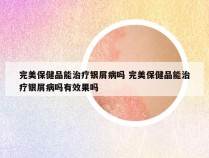 完美保健品能治疗银屑病吗 完美保健品能治疗银屑病吗有效果吗