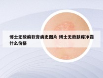 博士无敌癣软膏病史图片 博士无敌肤痒净霜什么价格