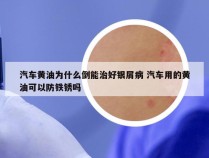 汽车黄油为什么倒能治好银屑病 汽车用的黄油可以防铁锈吗