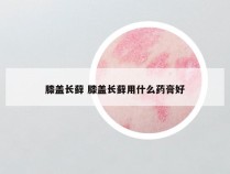 膝盖长藓 膝盖长藓用什么药膏好