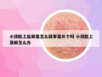 小孩脸上起癣是怎么回事是长个吗 小孩脸上涨癣怎么办