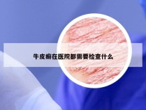 牛皮癣在医院都需要检查什么