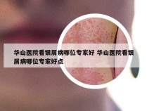 华山医院看银屑病哪位专家好 华山医院看银屑病哪位专家好点