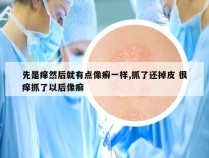 先是痒然后就有点像癣一样,抓了还掉皮 很痒抓了以后像癣