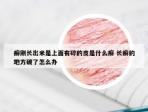 癣刚长出米是上面有碎的皮是什么癣 长癣的地方破了怎么办