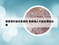 银屑病不能吃麦类吗 银屑病人不能吃哪些水果