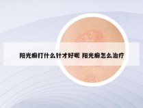 阳光癣打什么针才好呢 阳光癣怎么治疗