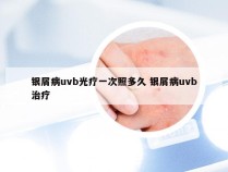 银屑病uvb光疗一次照多久 银屑病uvb治疗