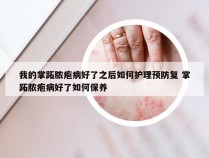 我的掌跖脓疱病好了之后如何护理预防复 掌跖脓疱病好了如何保养