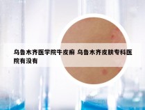 乌鲁木齐医学院牛皮癣 乌鲁木齐皮肤专科医院有没有